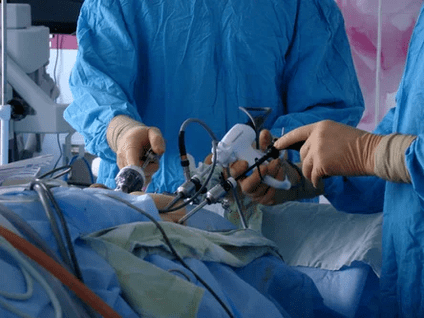 Intervención quirúrgica